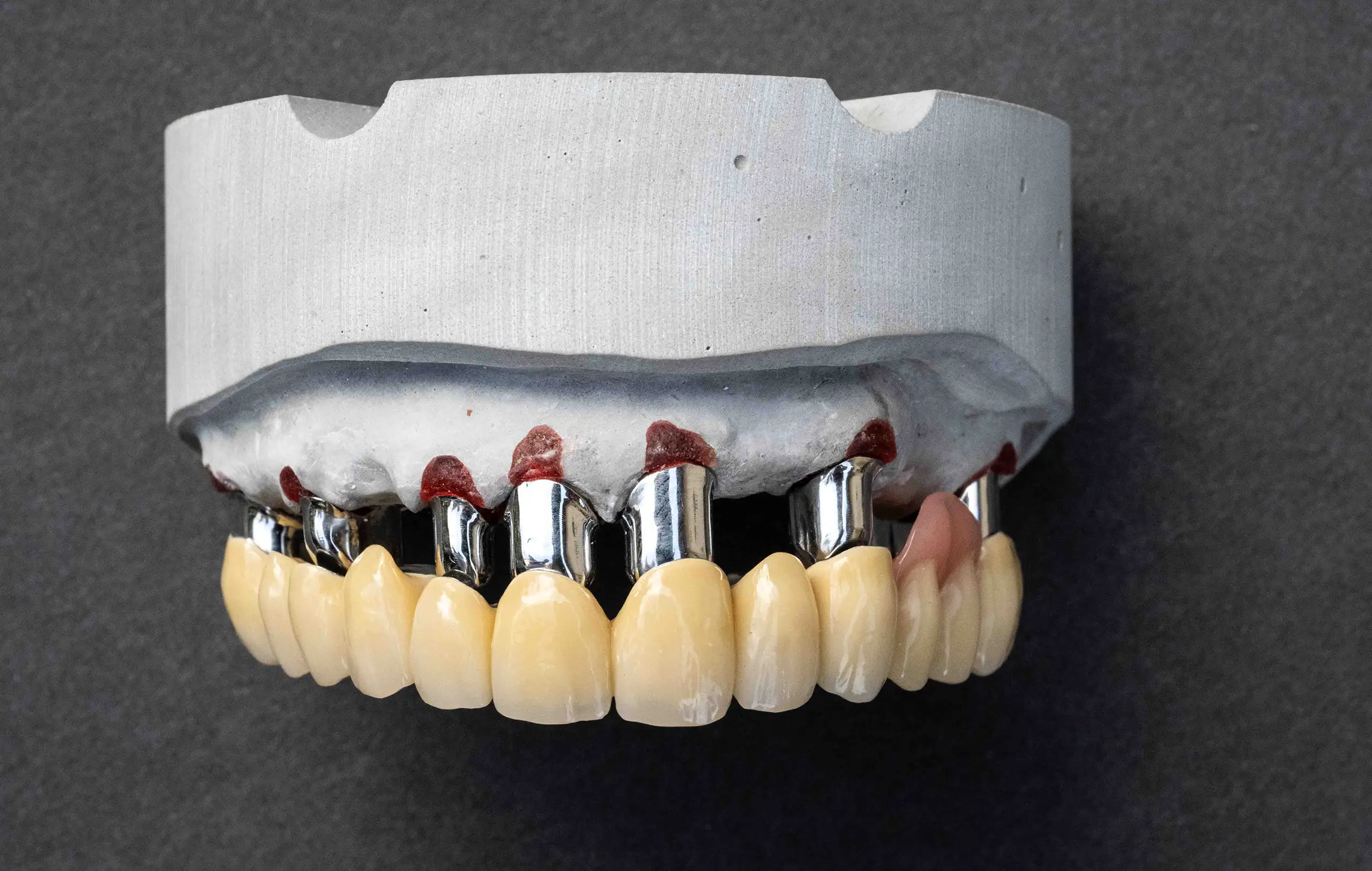 clearsplint-7300